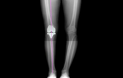 Cuvis Joint - Precise Cutting For Sub Millimeter