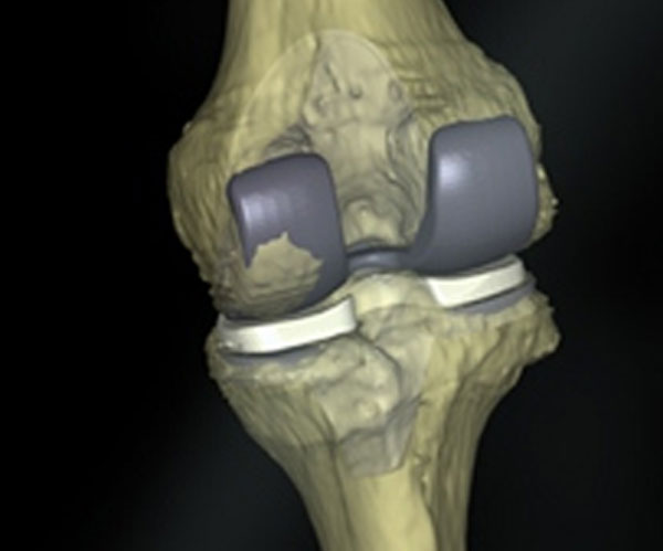 Cuvis Robotic - Pre Surgical Planning