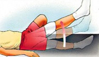Total Knee Replacement Surgery